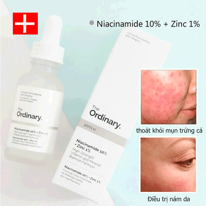 The Ordinary Niacinamide 10% + Zinc 1% Serum For All Skin Types