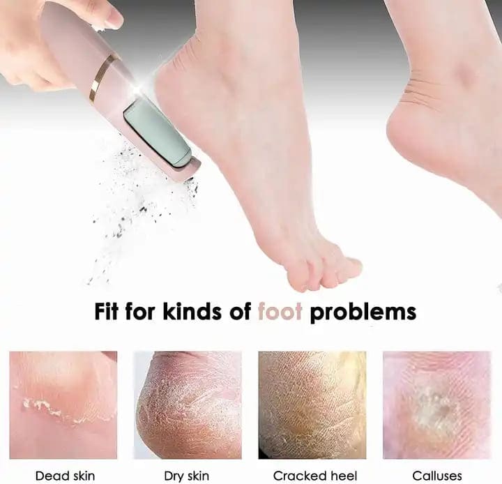 Flawless Pedi Electronic Tool File and Callus Remover