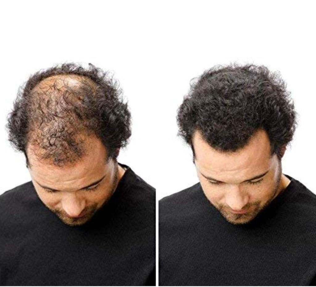 DeHair Fiber | For Men & Women